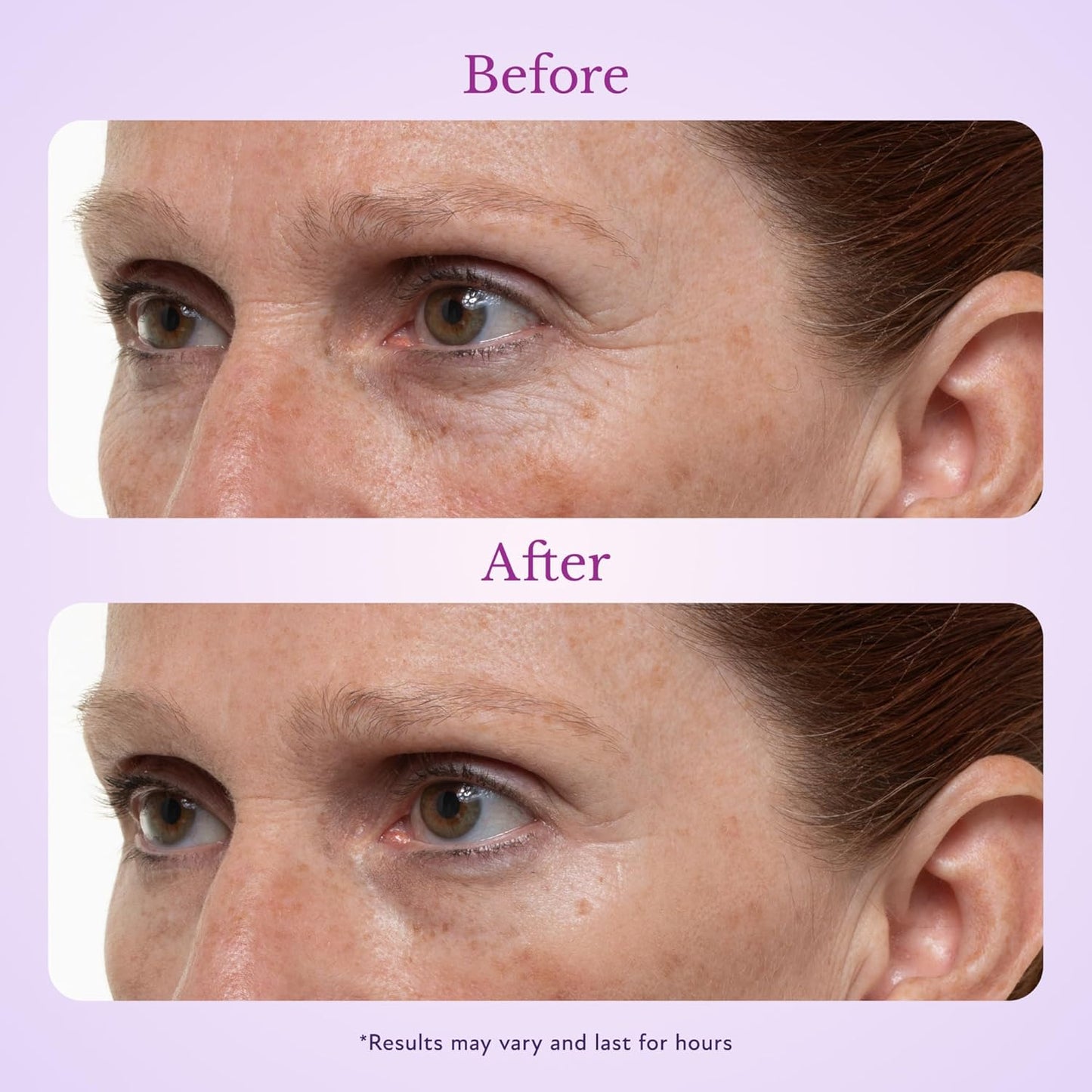 SmoothLift™ 60 Second Firming Gel