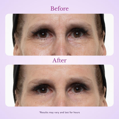 SmoothLift™ 60 Second Firming Gel